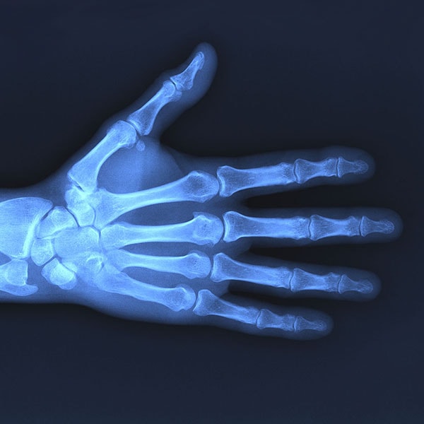 Röntgen - Radiologie Betzdorf